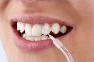 Зъбен душ / Орален иригатор SENCOR SOI 1310BL